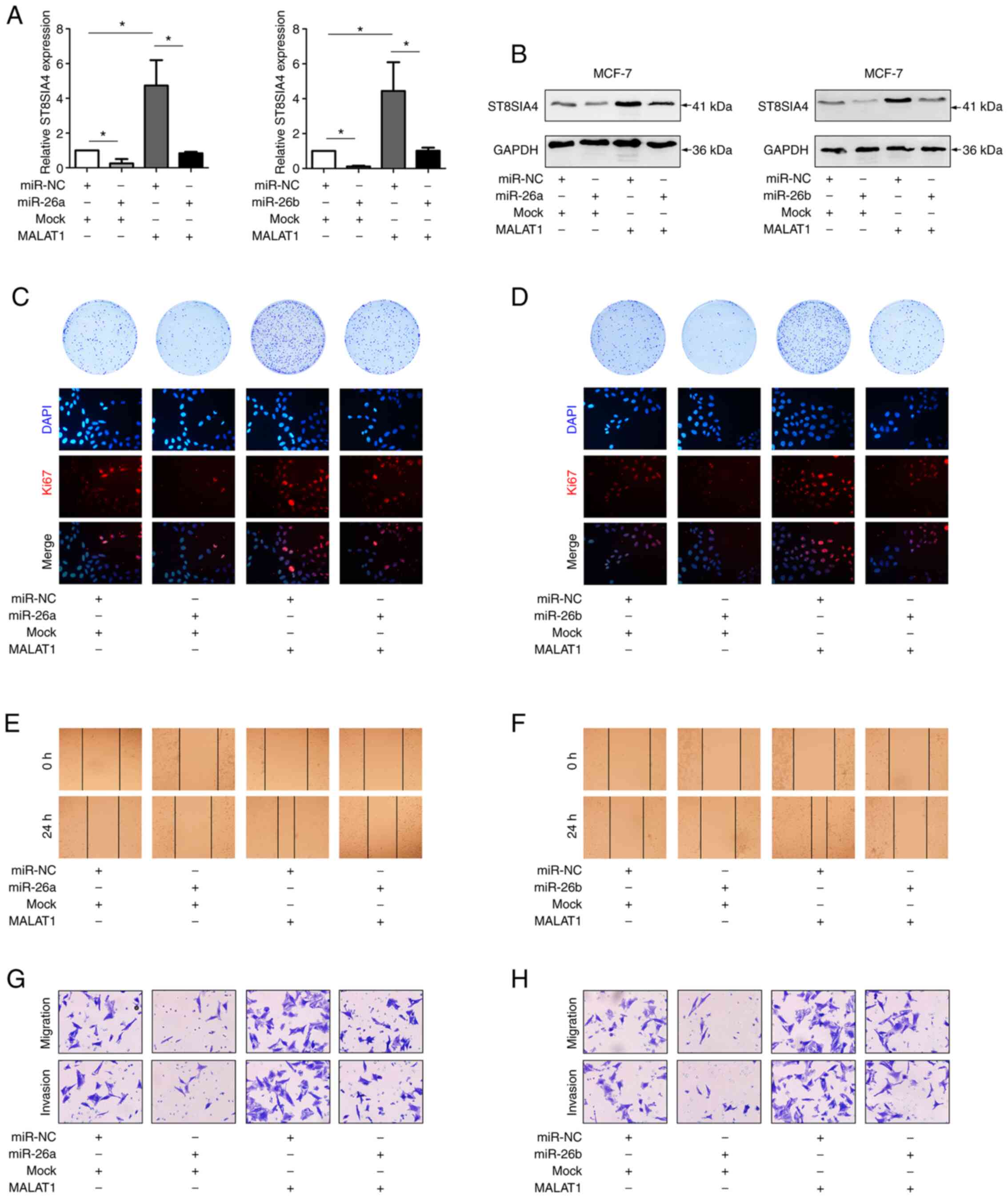 lncRNA MALAT1/miR‑26a/26b/ST8SIA4 axis mediates cell invasion and 