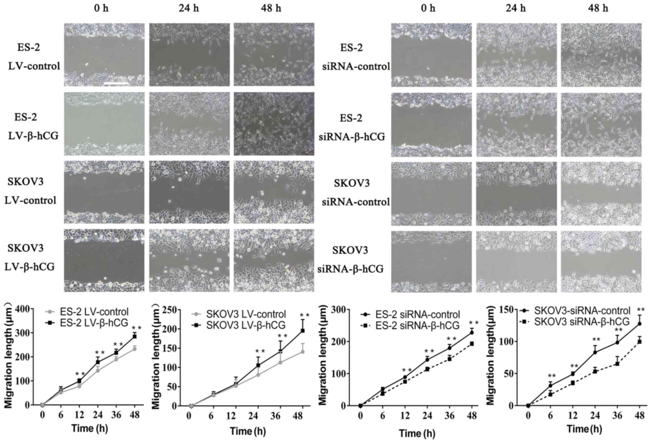 Wound-healing assay showed that β-hCG
regulates ovarian cancer cell migration in vitro
(**P<0.01).