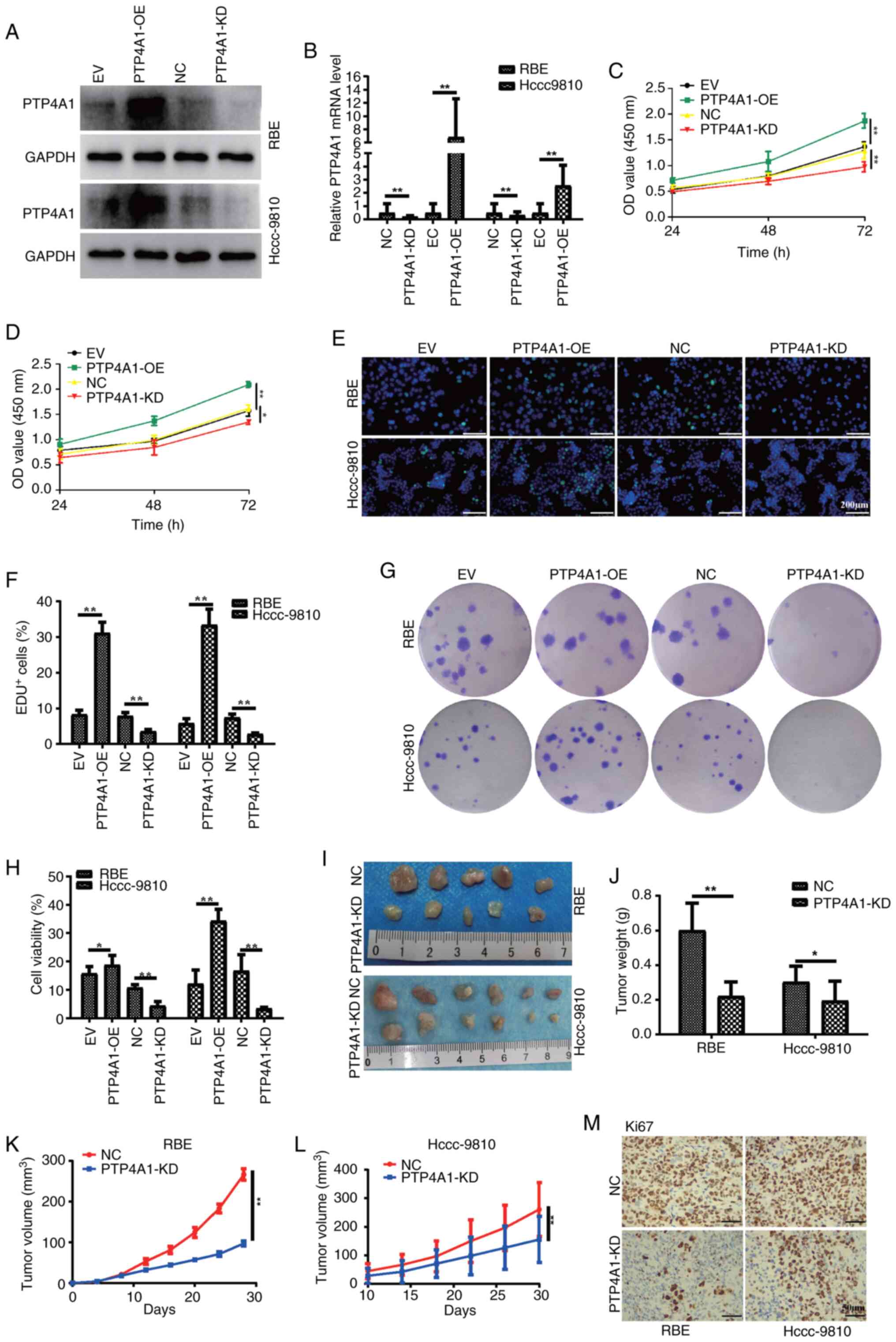 PTP4A1 promotes intrahepatic
cholangiocarcinoma cell proliferation in vitro and in
vivo. (A) Western blotting and (B) reverse
transcription-quantitative PCR were performed to detect PTP4A1 mRNA
and protein expression levels in RBE and HCCC-9810 cells stably
transfected with PTP4A1-OE or PTP4A1-KD lentivirus. (C and D) Cell
Counting Kit-8, (E and F) EdU and (G and H) cell colony formation
assays were used to evaluate the proliferation and viability of RBE
and HCCC-9810 cells stably transfected with PTP4A1-OE or PTP4A1-KD
lentivirus. (I) RBE and HCCC-9810 cells stably transfected with
PTP4A1-KD lentivirus and NC cells were injected into nude mice, and
subcutaneous xenograft tumors were successfully established (n=5
for each group). (J) Compared with those in the NC group, tumor
weight were significantly decreased in the PTP4A1-KD group. (K and
L) The tumor growth curves of RBE (K) and HCCC-9810 (L) cells in
nude mice. (M) Representative immunohistochemical staining for Ki67
in xenograft tumor tissues. *P<0.05 and **P<0.01. PTP4A1,
protein tyrosine phosphatase 4A1; OE, overexpression; KD,
knockdown; NC, negative control; EV, empty vector.