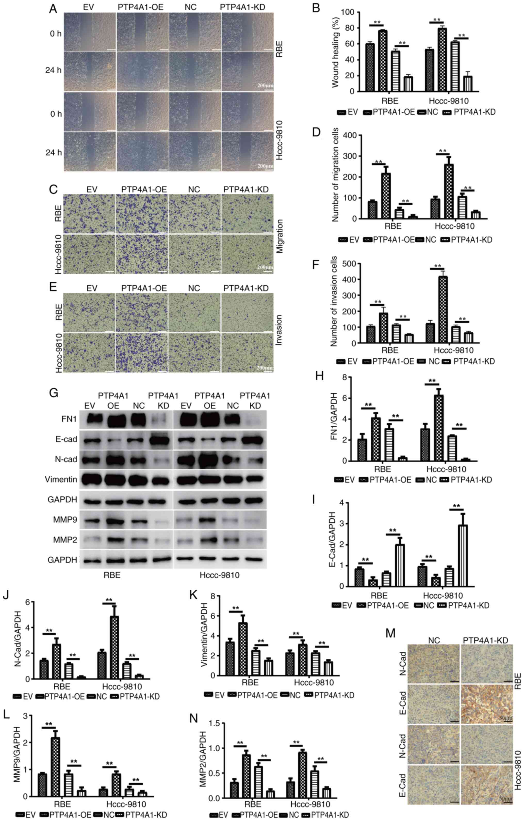 PTP4A1 promotes migration, invasion
and EMT in intrahepatic cholangiocarcinoma. (A and B) Wound healing
and (C and D) migration assays were used to detect the effect of
PTP4A1 on the migration of RBE and HCCC-9810 cells. Invasion assays
(E and F) were used to evaluate the invasion abilities of RBE and
HCCC-9810 cells stably transfected with PTP4A1-overexpressing and
PTP4A1-knockdown lentiviruses. (G) EMT marker and MMP2/MMP9
expression in RBE and HCCC-9810 cells stably transfected with
PTP4A1-OE and PTP4A1-KD lentiviruses. (H-N) Quantitative analysis
of (H) FN1, (I) E-cadherin, (J) N-cadherin, (K) Vimetin, (L) MMP9
and (N) MMP2 expression levels. (M) E-cadherin and N-cadherin
expression levels in tumorigenic tissues were measured by
immunohistochemistry. **P<0.01. PTP4A1, protein tyrosine
phosphatase 4A1; EMT, epithelial-mesenchymal transition; OE,
overexpression; KD, knockdown; NC, negative control; EV, empty
vector.