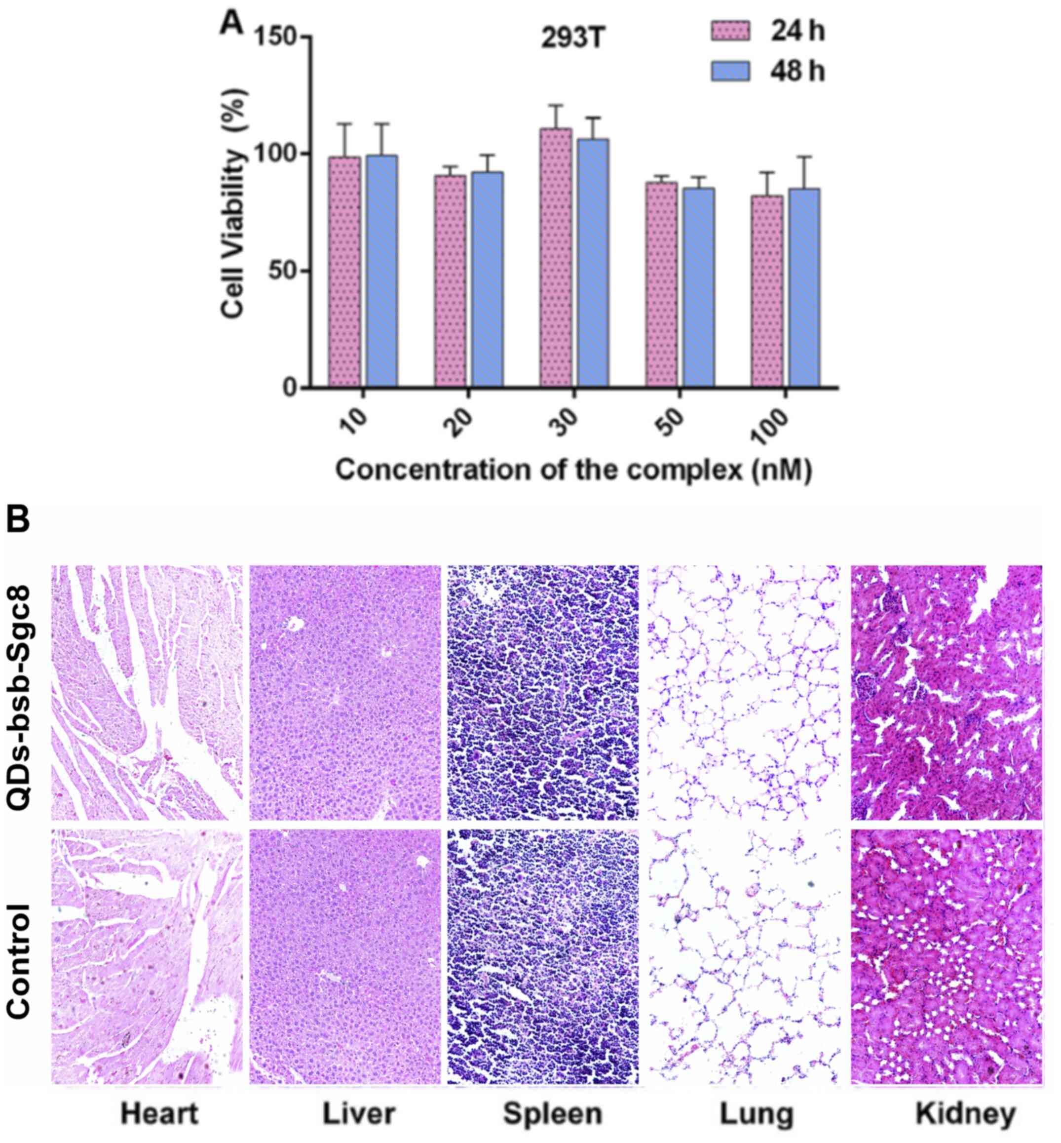 Non-toxicity of the QDs-bsb-apt
complex to 293T normal cells (A) and organs such as the heart,
liver, spleen, lung and kidney (B). 293T cells were incubated with
various concentrations of the QDs-bsb-Sgc8 complex (10, 20, 30, 50
and 100 nM) for 24 h (red column) or 48 h (blue column). (B)
Comparative safety assessment of QDs-bsb-Sgc8 compared with the PBS
group 20 days following a single intravenous administration in nude
mice (n=3). No histologic evidence of toxicity in any organ was
identified.