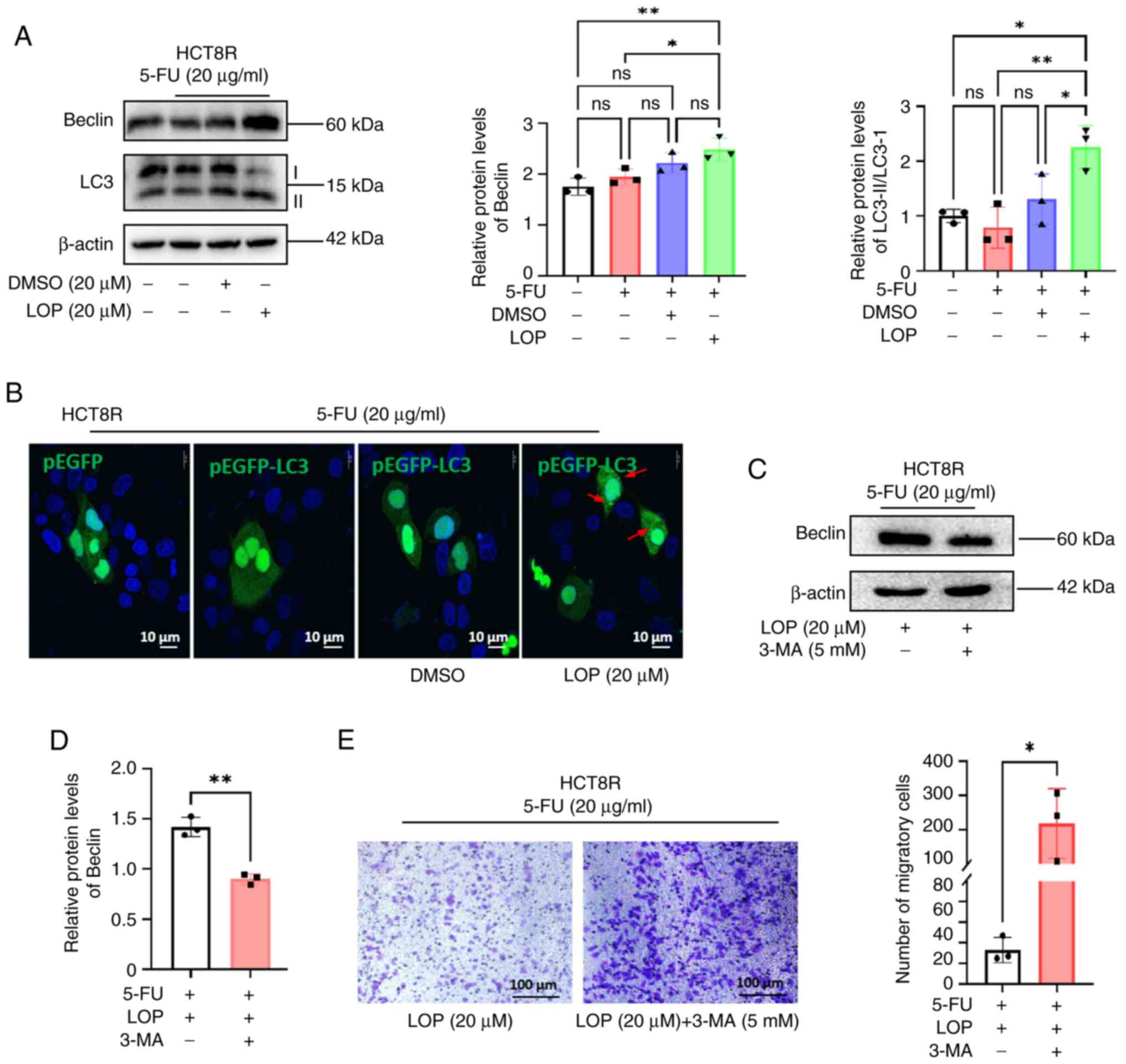 LOP enhances the inhibitory effects
of 5-FU on HCT8R cells through autophagy activation. (A) Western
blot analysis of changes in LC3 and Beclin protein expression in
HCT8R cells treated with LOP and 5-FU. (B) Confocal microscopy
images, showing the generation of autophagic vesicles in HCT8R
cells transfected with the EGFP-LC3 plasmid, and treated with LOP
and 5-FU. (C) Western blot analysis of Beclin protein expression in
HCT8R cells treated with or without 3-MA. (D) Statistical analysis
of changes in Beclin expression in HCT8R cells treated with or
without 3-MA. (E) Transwell assays were performed, assessing the
migratory capability of HCT8R cells treated with LOP, 5-FU, with or
without 3-MA. *P<0.05, **P<0.01 (n=3). 3-MA, 3-methyladenine;
5-FU, 5-fluorouracil; DMSO, dimethyl sulfoxide; LC3,
microtubule-associated protein 1 light chain 3; LOP, loperamide;
ns, not significant.