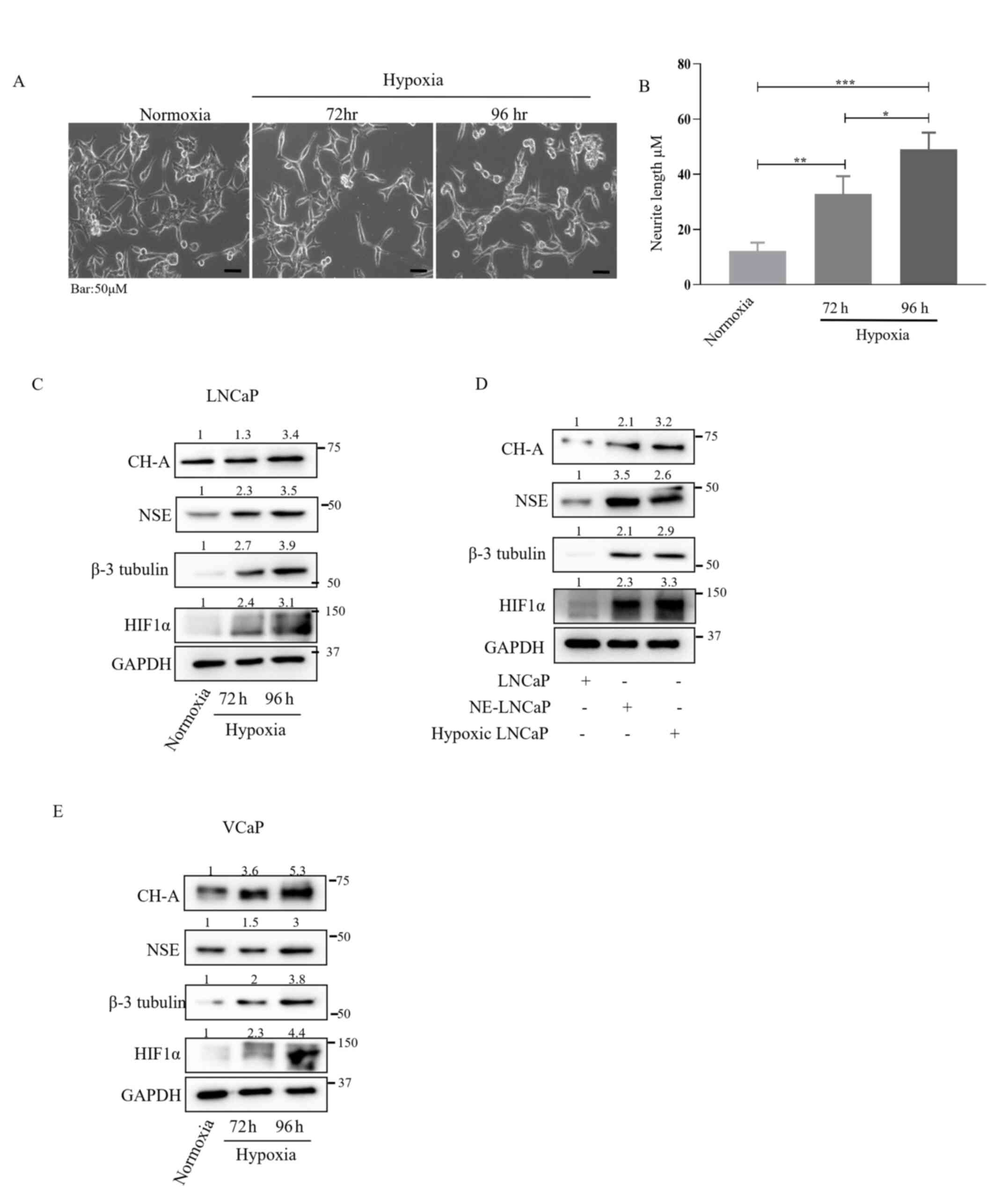 Hypoxia-induced NE differentiation in
prostate cancer cells. (A) LNCaP cells were exposed to a hypoxic
environment for different durations. (B) Neurite outgrowth was
assessed using bright-field microscopy and quantified with ImageJ
(1.50i; National Institutes of Health). Bar graphs represent the
mean ± SD from three independent experiments (C) and (E) Expression
of NE markers was evaluated in hypoxia-induced LNCaP and VCaP
cells. (D) Expression of NE markers in LNCaP, in vitro
derived NE-LNCaP cells, and hypoxia-treated LNCaP cells was
determined by western blotting. The data represent the mean ± SD
for three independent experiments, with *P<0.05, **P<0.01 and
***P<0.001. NE, neuroendocrine.