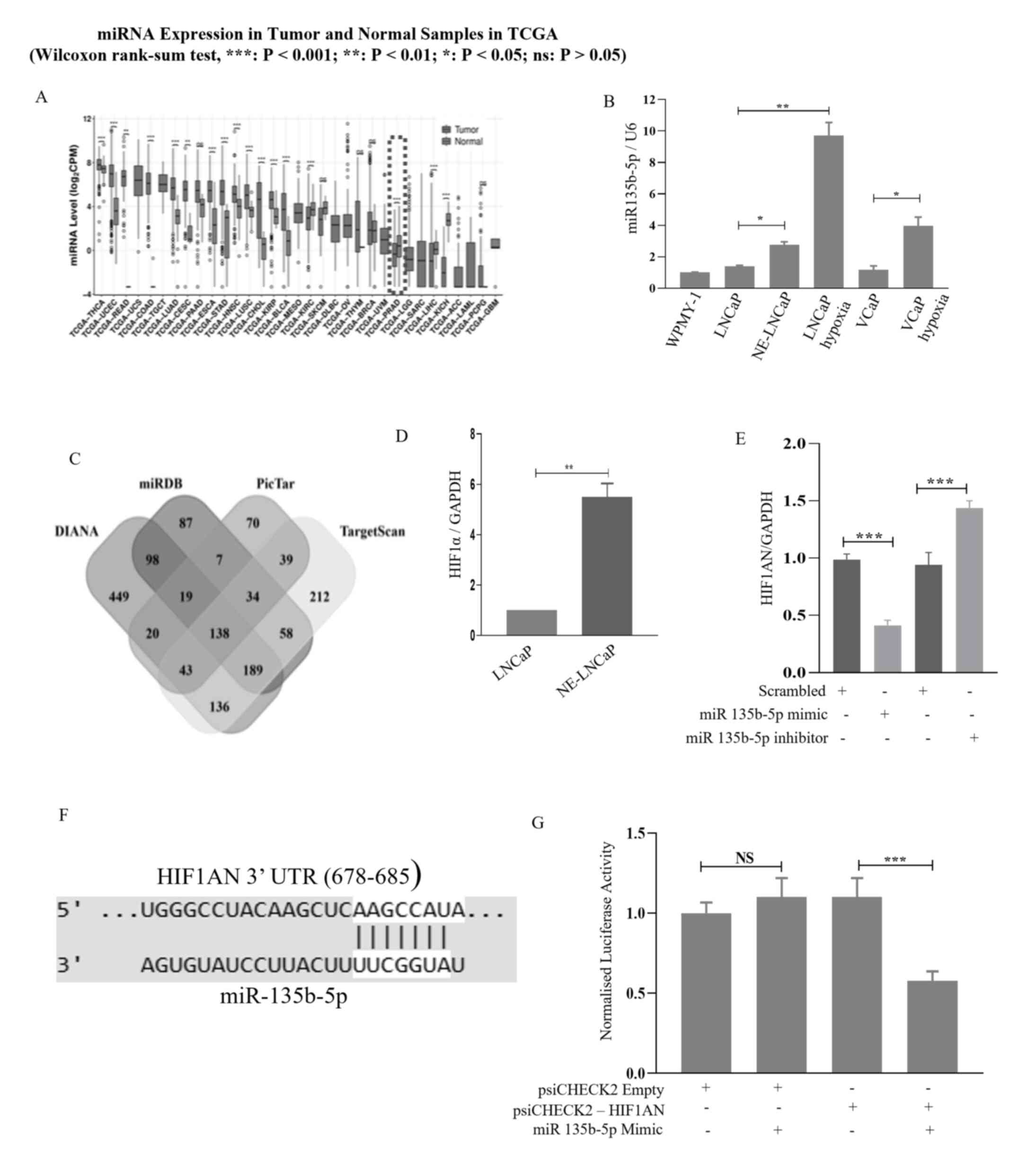 miR-135b-5p is overexpressed in
hypoxia-induced NE prostate cancer. (A) Expression levels of
miR-135b-5p in various cancers were analyzed using the
CancerMIRNome database which derives its expression data from The
Cancer Genome Atlas database, an open access resource. (B)
miR-135b-5p expression was assessed by RT-qPCR in WPMY-1, LNCaP,
NE-LNCaP, and also hypoxia-treated LNCaP and VCaP cells. (C) Venn
diagram showing the predicted common target genes of miR-135b-5p.
(D) Relative expression of HIF1α was measured in LNCaP and NE-LNCaP
cells using RT-qPCR. (E) NE-LNCaP cells were transfected with a
miR-135b-5p mimic or inhibitor, and HIF1AN expression was analyzed
by RT-qPCR. (F) and (G) Luciferase reporter assays were performed
to confirm direct binding of miR-135b-5p to the 3′UTR region of
HIF1AN. Data are presented as the mean ± SD from three independent
experiments. The data represent mean ± SD for three independent
experiments, with *P<0.05, **P<0.01 and ***P<0.001. miR,
microRNA; NE, neuroendocrine; RT-qPCR, reverse
transcription-quantitative polymerase chain reaction; ns, not
significant.
