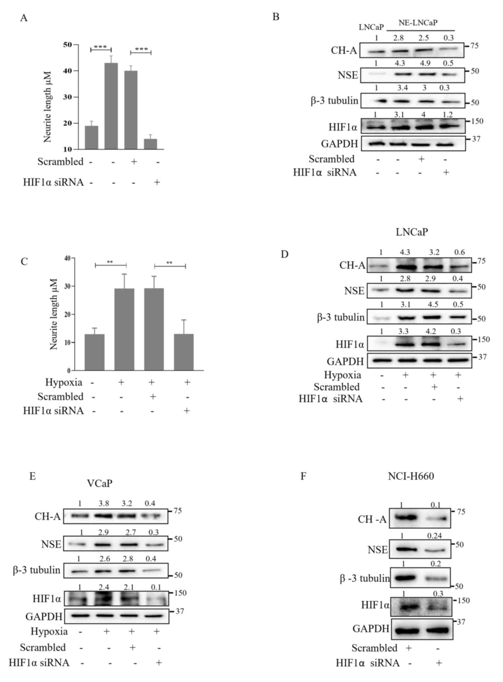 HIF1α downregulation attenuates NE
differentiation of prostate cancer cells under hypoxia. (A and B)
HIF1α was downregulated using siRNA in NE-LNCaP cells, and
phenotypic changes were assessed by measuring neurite length and
expression of NE markers was evaluated by western blotting. (C and
D) HIF1α was silenced in LNCaP cells under hypoxia, and
morphological changes were assessed by quantifying neurite
outgrowth using bright-field microscopy and ImageJ, and expression
levels of NE markers and HIF1α were determined by western blotting.
(E and F) VCaP cells under hypoxia and NCI-H660 cells were
transfected with HIF1α siRNA. Expression of NE markers was analyzed
by western blotting. The data are presented as the mean ± SD from
three independent experiments. **P<0.01 and ***P<0.001. si-,
small interfering; NE, neuroendocrine; HIF1α, hypoxia inducible
factor alpha-1; CH-A chromogranin A.