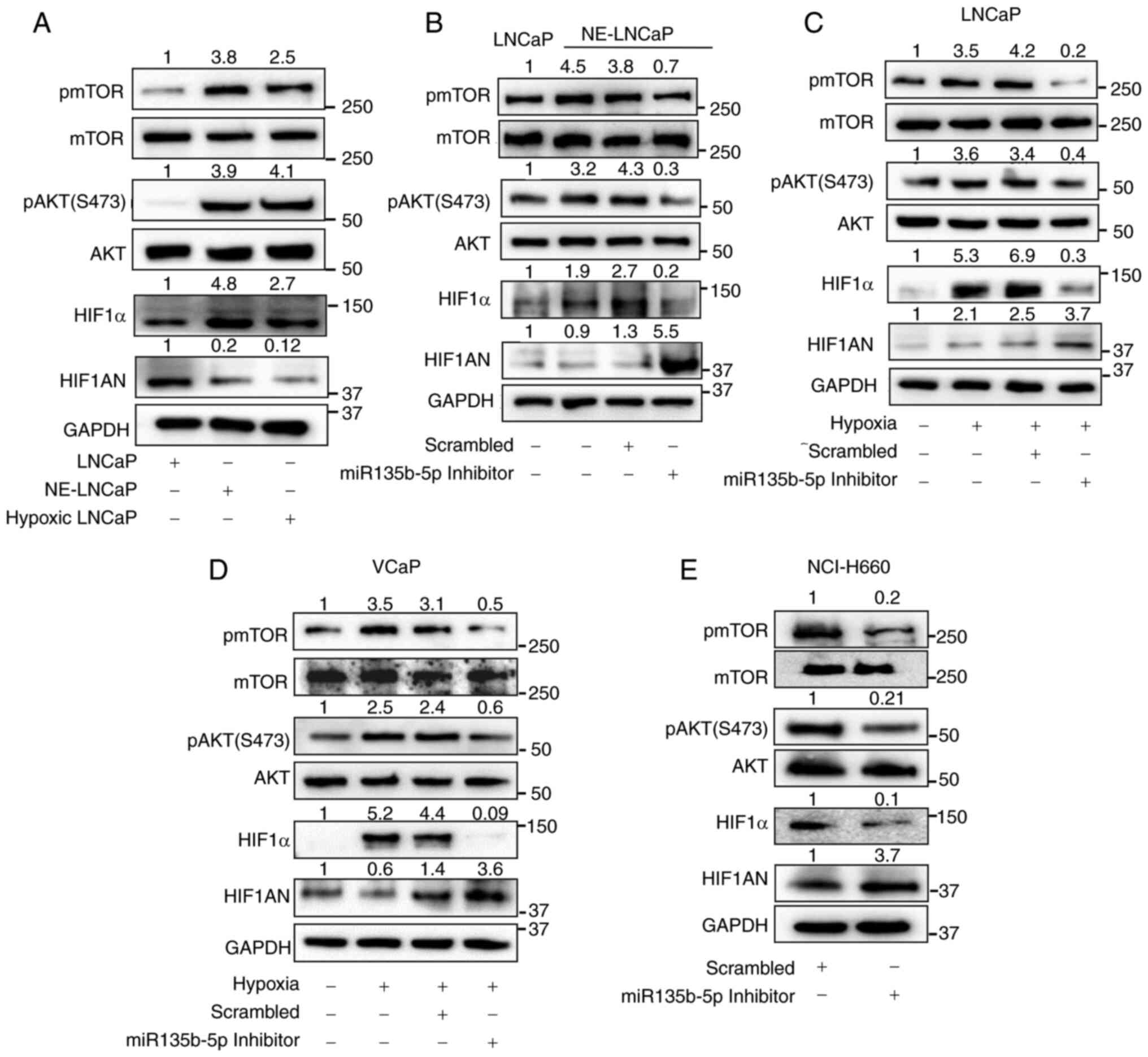 Inhibition of miR-135b-5p attenuates
NE prostate cancer progression via the AKT/mTOR signaling pathway.
(A) Expression and activation of AKT/mTOR pathway components and
hypoxia-associated markers were evaluated in LNCaP, NE-LNCaP and
hypoxia-treated LNCaP cells by western blotting. (B-E) NE-LNCaP,
LNCaP, VCaP under hypoxia, and NCI-H660 cells were transfected with
a miR-135b-5p inhibitor, and the expression of AKT/mTOR pathway and
hypoxia-associated markers was analyzed by western blotting. miR,
microRNA; NE, neuroendocrine; HIF1α, hypoxia inducible factor
alpha-1; HIF1AN, hypoxia inducible factor alpha-1 subunit alpha
inhibitor; p-, phosphorylated.