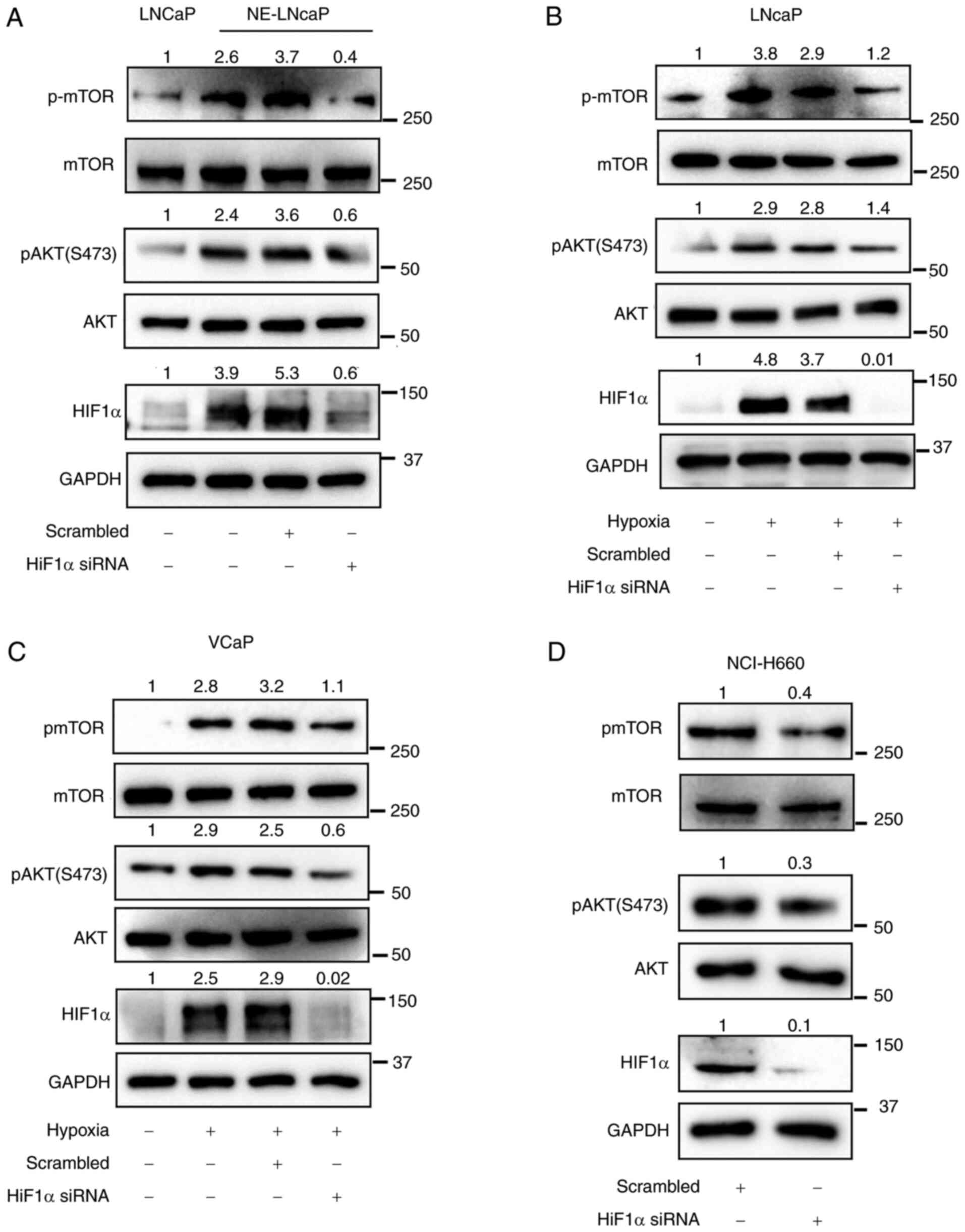 Downregulation of HIF1α hampers
AKT/mTOR-mediated induction of NE differentiation. (A) NE-LNCaP
cells were transfected with HIF1α siRNA, and expression of HIF1α
and AKT/mTOR pathway markers was analyzed by western blotting.
(B-D) Hypoxia-treated LNCaP and VCaP, and also NCI-H660 cells, were
transfected with HIF1α siRNA, and the expression of HIF1α and
AKT/mTOR pathway components was assessed by western blotting. NE,
neuroendocrine; siRNA, small interfering RNA; HIF1α, hypoxia
inducible factor alpha-1; p-, phosphorylated.
