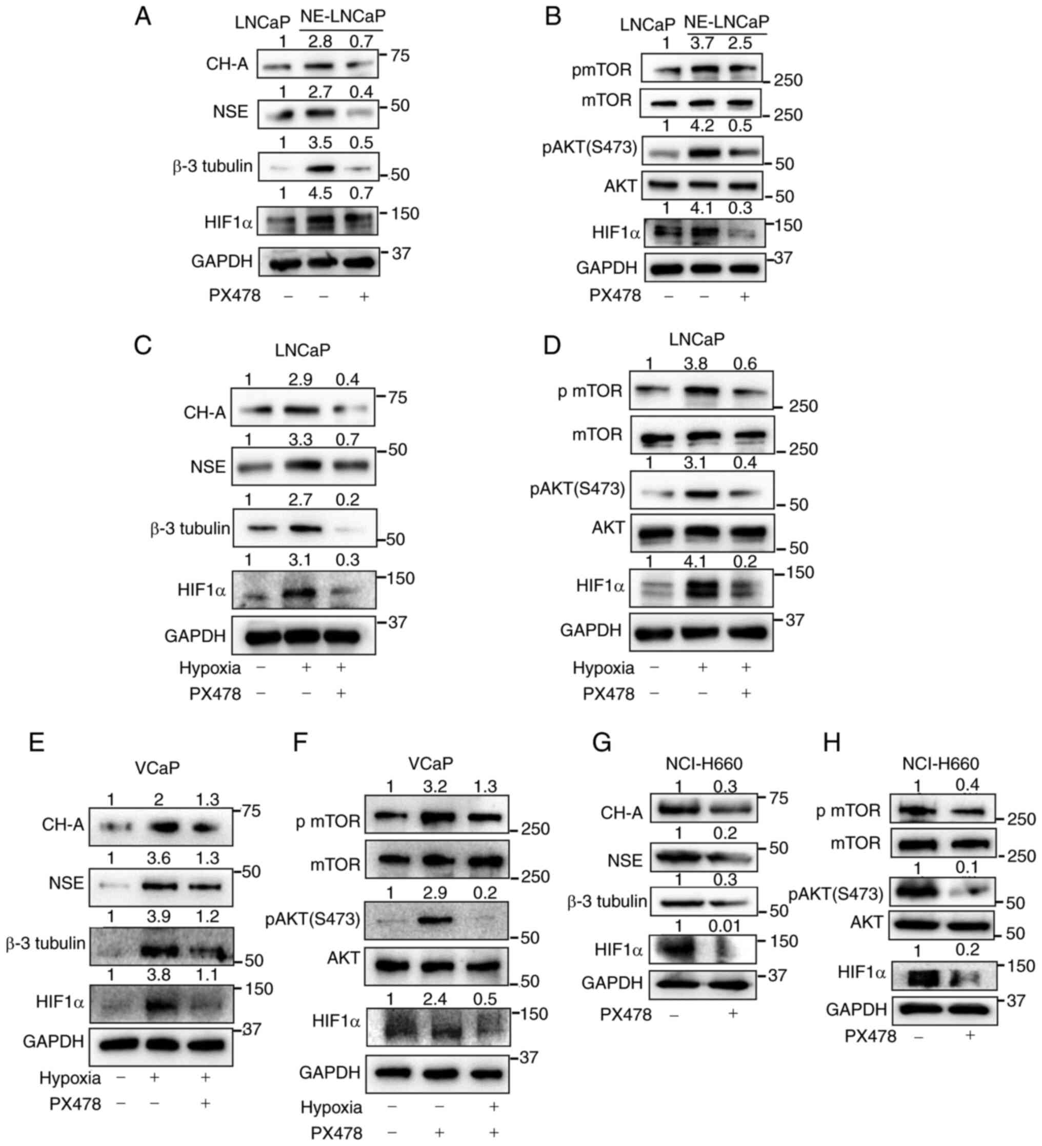 PX-478, a HIF1α inhibitor, suppresses
NE differentiation of PCa cells. (A and B) NE-LNCaP cells were
treated with PX-478, and the expression of NE markers, AKT/mTOR
pathway components, and HIF1α was assessed by western blotting.
(C-F) LNCaP and VCaP cells were treated with PX-478 under hypoxic
conditions, and changes in NE markers, AKT/mTOR pathway proteins,
and HIF1α were analyzed by western blotting. (G and H) NCI-H660
cells were treated with PX-478, and the expression of NE markers,
AKT/mTOR pathway components, and HIF1α was determined by western
blotting. PX-478, S-2-amino-3-[4′-N, N,-bis (chloroethyl) amino]
phenyl propionic acid N-oxide dihydrochloride; NE, neuroendocrine;
HIF1α, hypoxia inducible factor alpha-1; CH-A chromogranin A.