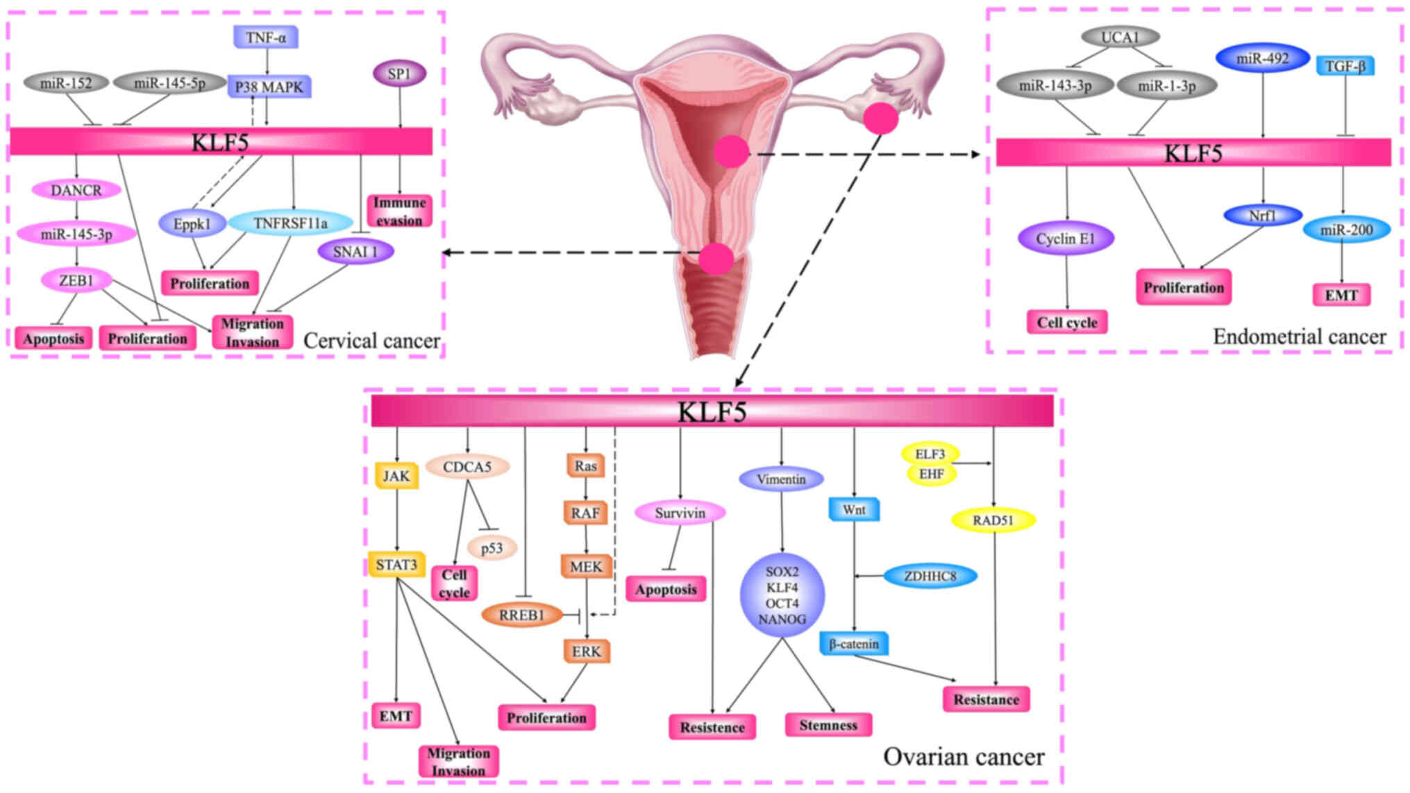 A part of the mechanism of KLF5
regulating gynecological tumors. This schematic diagram illustrates
the multifaceted roles of KLF5 in cervical, ovarian and endometrial
cancers. Functional biological processes including cell
proliferation, apoptosis, migration, invasion, chemoresistance and
immune regulation are represented in pink. KLF5 functions as a
transcriptional regulatory hub, integrating various upstream
regulatory signals to coordinate downstream oncogenic cascades
across different gynecological cancer types. Arrows indicate
activating (→) or inhibitory (⊣) regulatory relationships. EMT,
epithelial-mesenchymal transition; UCA1, urothelial carcinoma
associated 1; SNAI1, snail family transcriptional repressor 1;
ZEB1, zinc finger E-box binding homeobox 1. KLF5, Krüppel-like
factor 5.