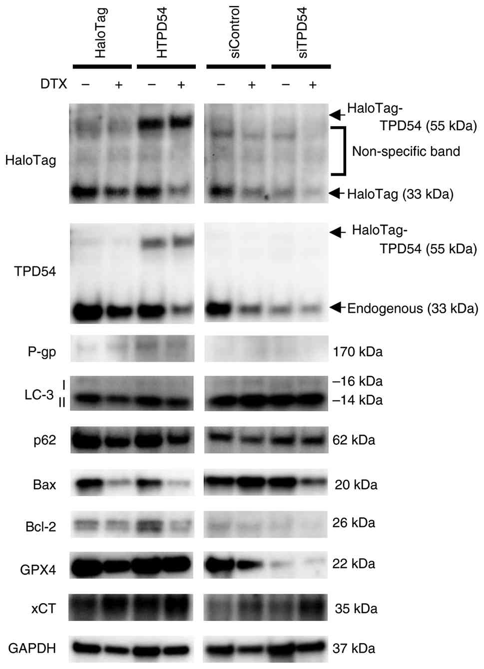 Effects of overexpression or knockdown
of TPD54 on the expression of cell death-related proteins in HSC-3
cells. Overexpression vectors (HaloTag or HaloTag-TPD54) or small
interfering RNAs were transfected into HSC-3 cells. Cells were
incubated in the absence (−) or presence (+) of DTX for 48 h and
subjected to western blot analysis for HaloTag, TPD54, P-gp, Bax,
Bcl-2, GPX4, xCT/SLC7A11 and GAPDH. Representative western blots
from three independent experiments are shown. P-gp, P-glycoprotein;
GPX4, glutathione peroxidase 4; DTX, docetaxel.