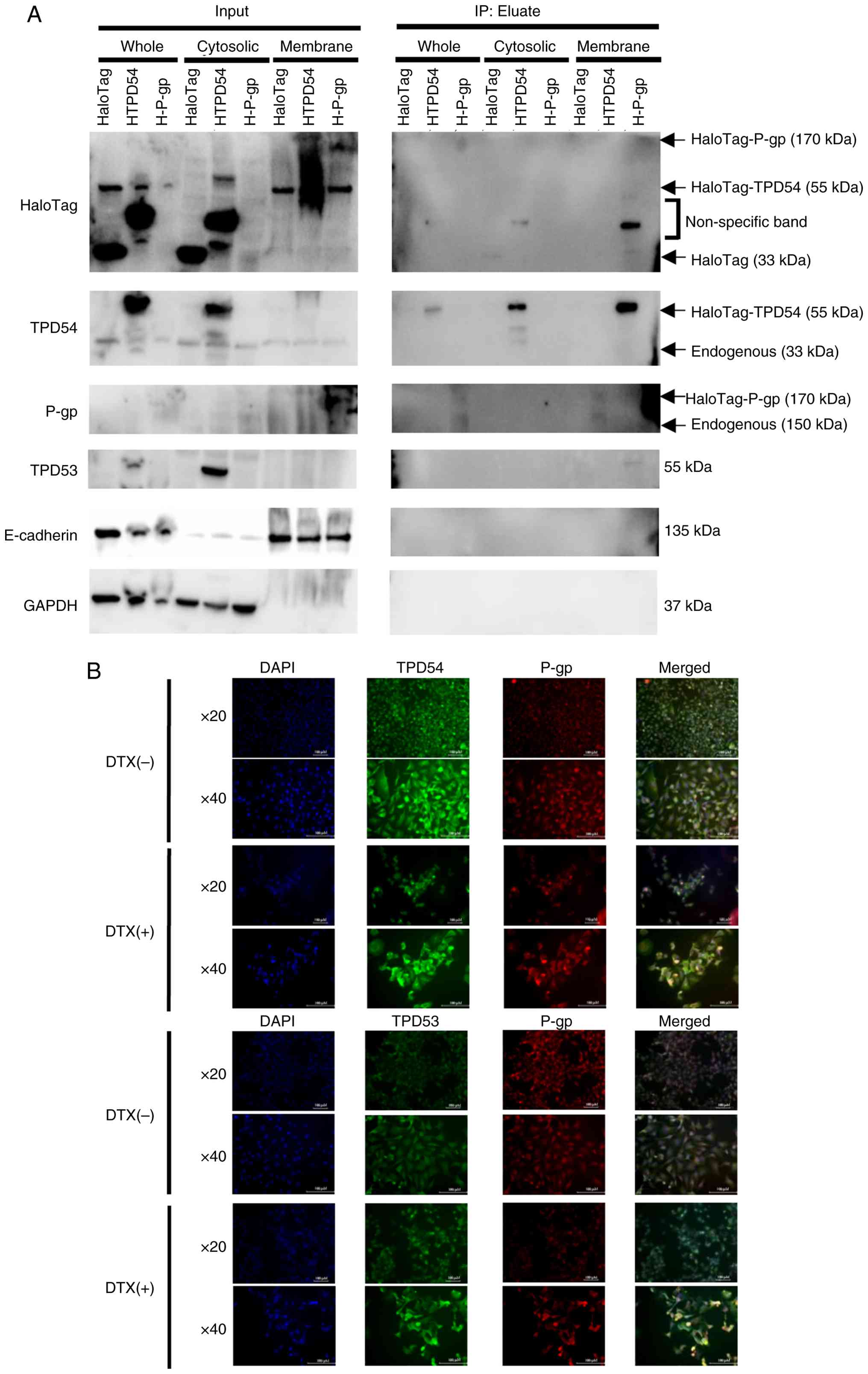 Association of TPD54 with
intracellular localization of P-gp. (A) HaloTag
co-immunoprecipitation assay. HaloTag or HaloTag-TPD54 expression
vectors were transfected into SAS cells, followed by HaloTag
immunoprecipitation and western blot analysis for HaloTag, TPD54,
P-gp, TPD53, E-cadherin and GAPDH. (B) Immunocytofluorescence
analysis of endogenous TPD53, TPD54 and P-gp in SAS cells with DAPI
nuclear staining. Representative results from three independent
experiments are shown. P-gp, P-glycoprotein; DTX, docetaxel.