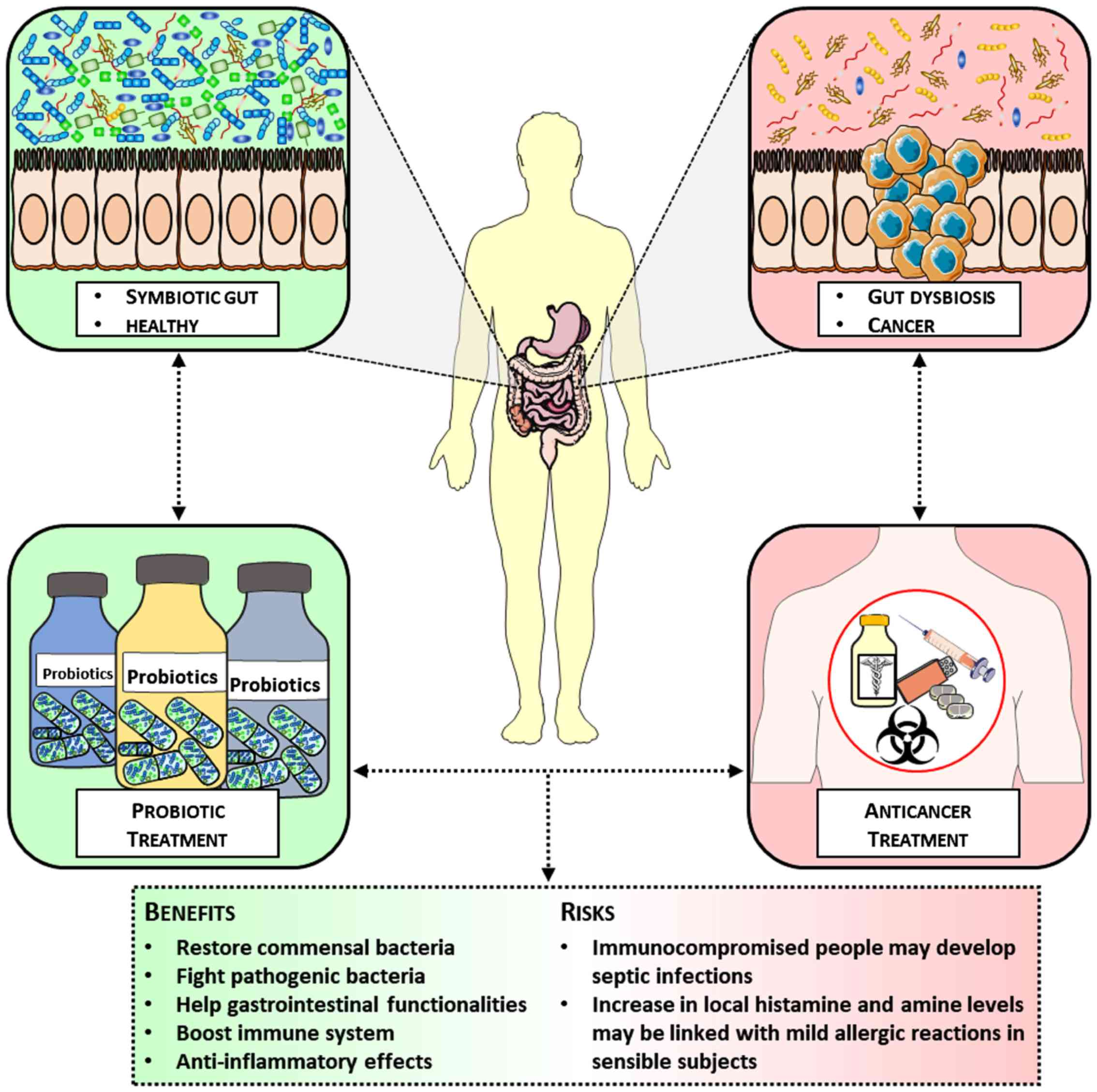 Anti-carcinogenic effects of certain probiotics