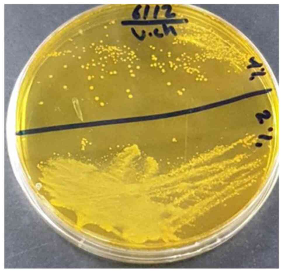 Colonies of Vibrio cholerae
isolated from water samples growing on thiosulfate-citrate-bile
salt (TCBS) agar.