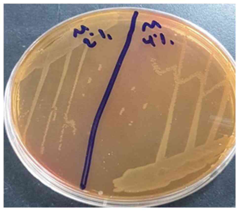 Colonies of Morganella
morganii isolated from water samples growing on MacConkey
agar.