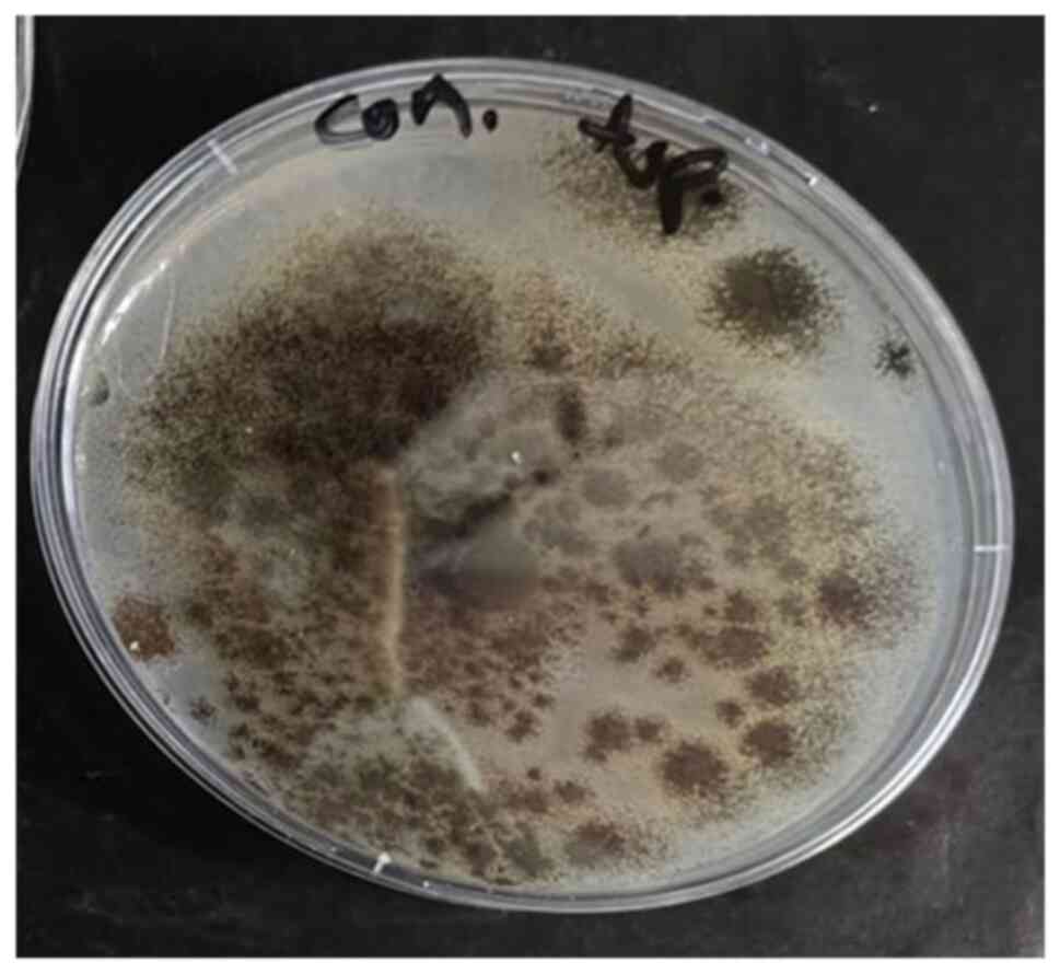 Colony of Aspergillus niger
isolated from water samples growing on potato dextrose agar
(PDA).