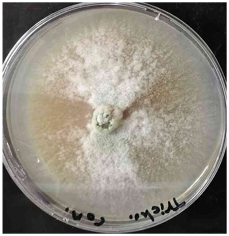 Colony of Trichoderma
harzianum isolated from water samples growing on potato
dextrose agar (PDA).